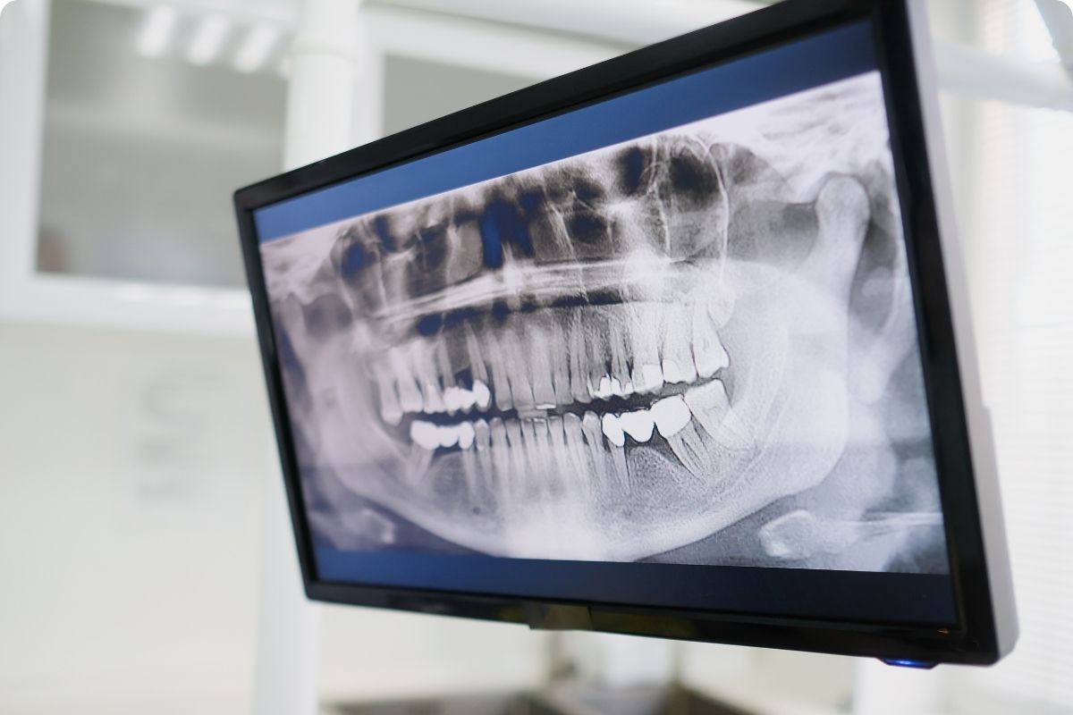 2026 Guide to CHAS Blue Card Dental Subsidies