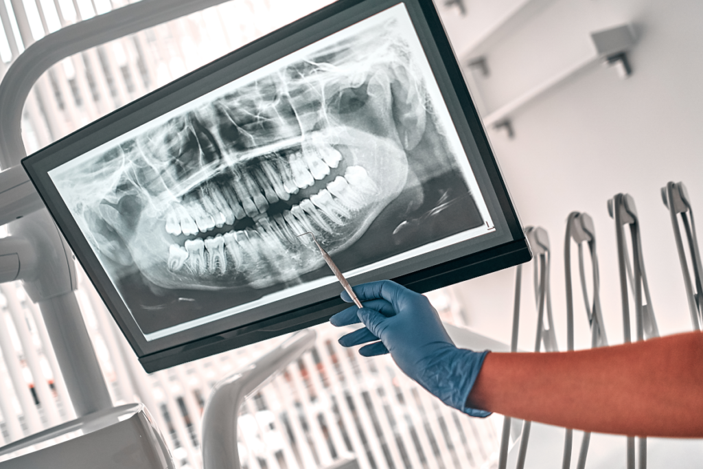 X-ray