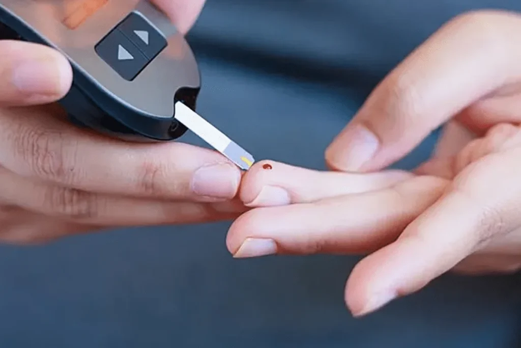 Best Diabetes Reversal Expert