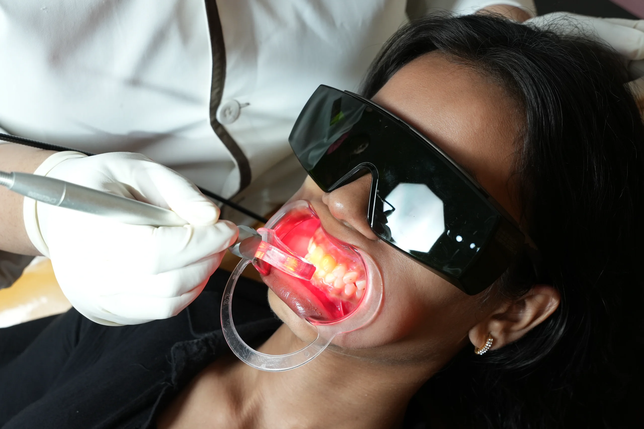 Lasers Reach the Neighbourhood Clinic: What Laser Dentistry Singapore Patients Should Know