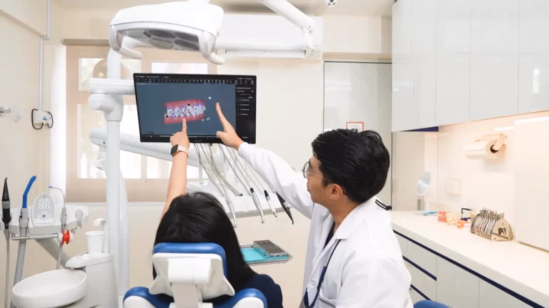 Self-Ligating Braces Singapore