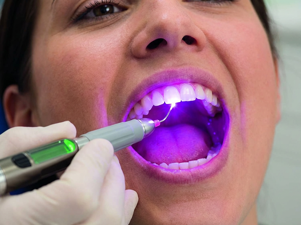 Laser Dentistry Singapore